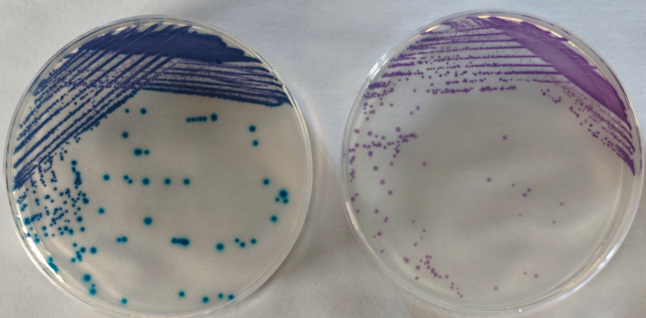 沙門檢測新助手—沙門氏+顯色培養基 沙門檢測新助手—沙門氏+顯色培養基